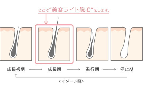 ライト脱毛